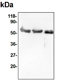 SHMT | Serine hydroxymethyltransferase in the group Antibodies Plant/Algal / Mitochondria | Respiration at Agrisera AB (Antibodies for research) (AS05 075)